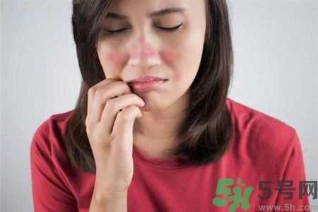 皮膚又紅又癢怎么辦？酒糟皮膚怎么治？