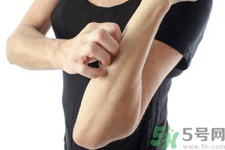 皮膚炎癢是怎么回事？皮膚炎發(fā)作怎么治療？