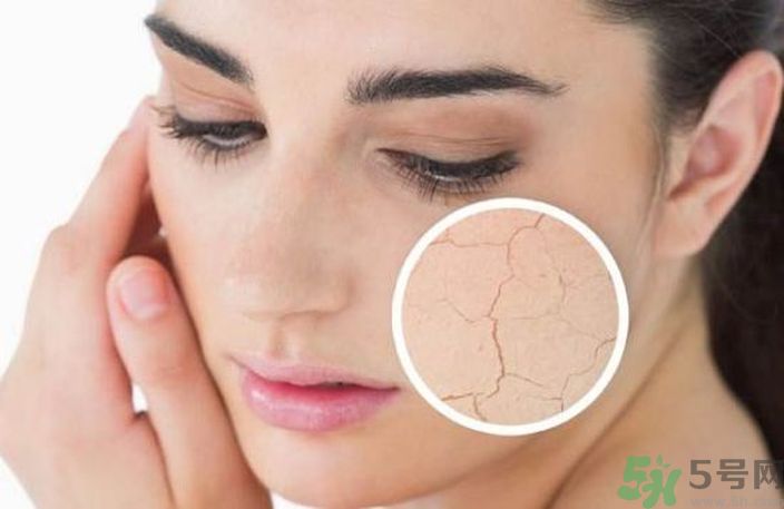 皮膚起皮怎么辦？皮膚起皮用什么護膚品？