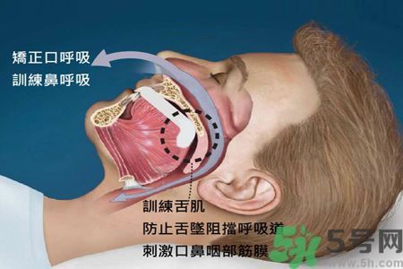 耳鳴是什么原因引起的？耳鳴怎么治療最好？