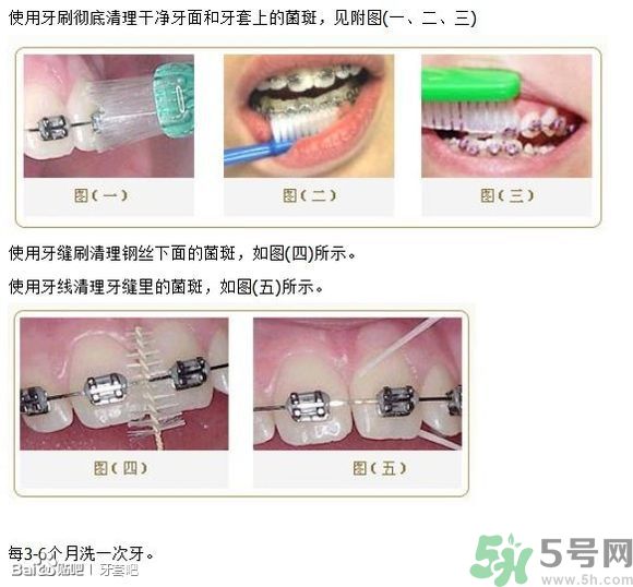 18歲還能戴牙套嗎？戴牙套真的能瘦臉改變臉型嗎？