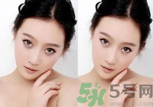 我的黑眼圈為什么是咖啡色的？怎么去除咖啡色黑眼圈？