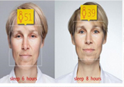 失眠會(huì)變丑嗎？失眠的人易變丑是真的嗎？