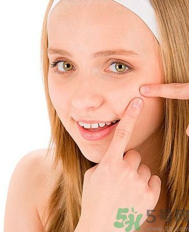 臉上有痘印怎么去除？去除痘印的小妙方？