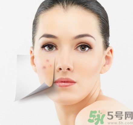 臉上有斑怎么去除？祛斑的小偏方有哪些？