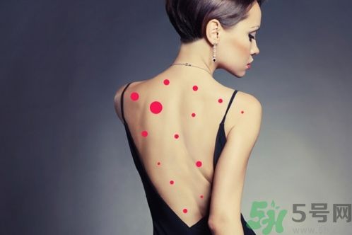 背上為什么會長痘痘？長痘痘怎么辦？