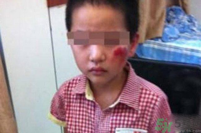 男孩遭校長(zhǎng)暴打的結(jié)果是什么？男孩遭校長(zhǎng)暴打的真相是什么？