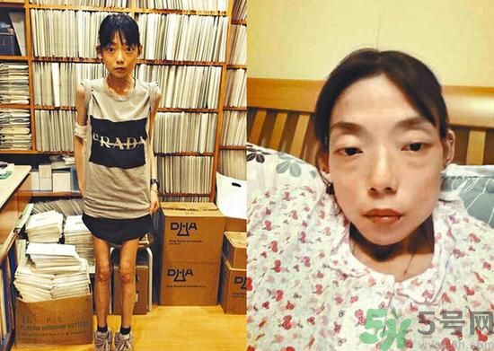 富二代離婚娶二線女星前妻瘦成骷髏  怎么選擇有責(zé)任的男人？