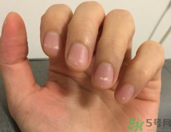 指露橫紋是不健康嗎?指露橫紋是什么原因 指露橫紋是不健康嗎?指露橫紋是什么原因
