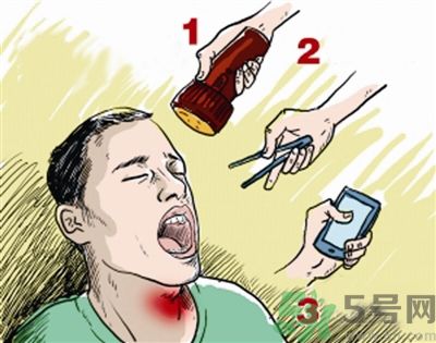 魚刺卡喉喝醋可以治療嗎？魚刺卡喉喝醋好不好？