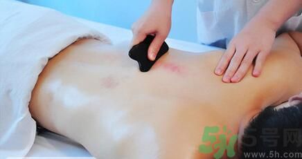 夏季刮痧好嗎？刮痧能治療什么疾??？