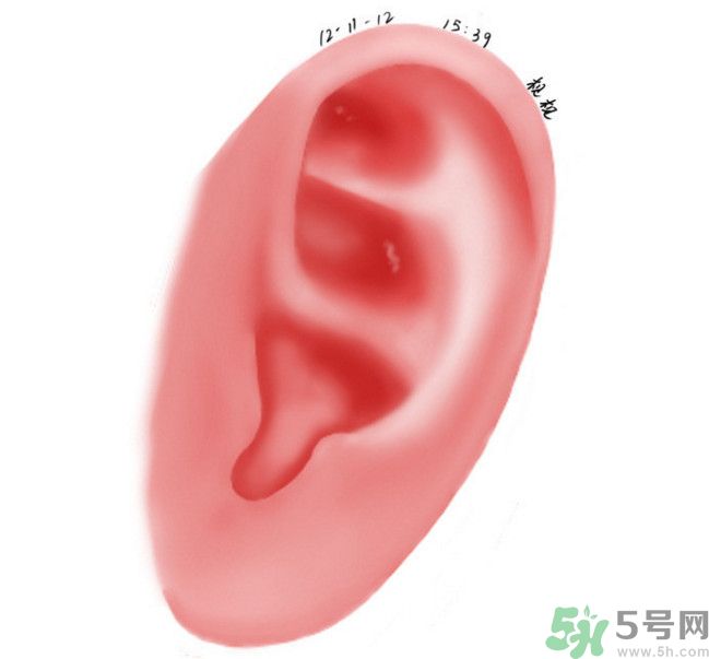 耳石脫落導(dǎo)致的眩暈怎么辦？耳石癥暈眩能自愈嗎？