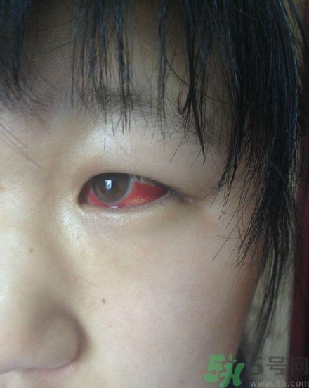 初中生全體甲醛中毒是怎么回事？初中生全體甲醛中毒是哪個學(xué)校？