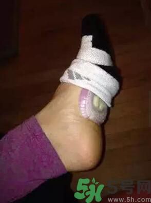 發(fā)燒可以吃洋蔥嗎？發(fā)燒能吃洋蔥嗎？