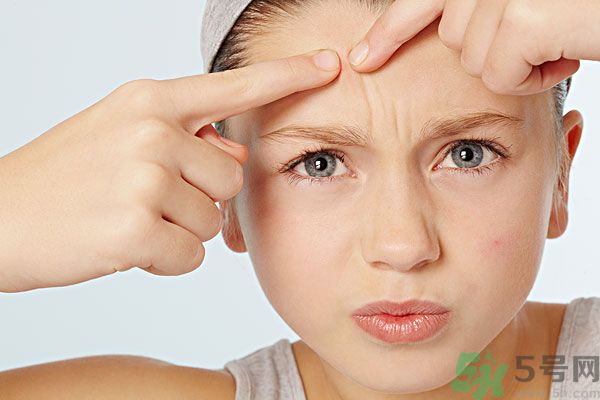 啪啪啪可以祛痘嗎？啪啪啪能夠去痘痘嗎？