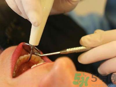 經(jīng)期可以拔牙嗎?經(jīng)期拔牙有什么危害 經(jīng)期可以拔牙嗎?經(jīng)期拔牙有什么危害