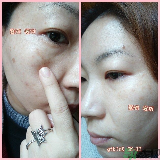 sk2祛斑精華怎么樣？skii祛斑精華使用方法