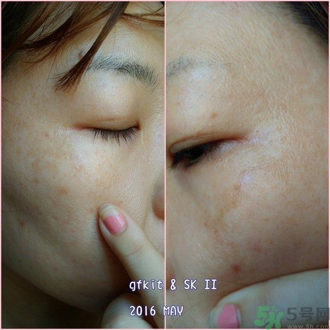 sk2祛斑精華怎么樣？skii祛斑精華使用方法