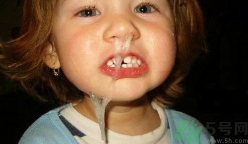 寶寶流鼻涕是怎么回事?寶寶流鼻涕怎么辦最簡(jiǎn)單方法夏天 寶寶流鼻涕是怎么回事?寶寶流鼻涕怎么辦最簡(jiǎn)單方法夏天