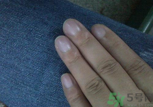 指甲發(fā)紫是什么原因？指甲發(fā)紫是怎么回事？