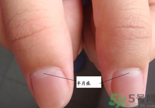 指甲沒有月牙是什么原因？指甲沒有月牙怎么調(diào)理？
