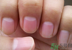 指甲沒(méi)有月牙是什么原因？指甲沒(méi)有月牙怎么調(diào)理？