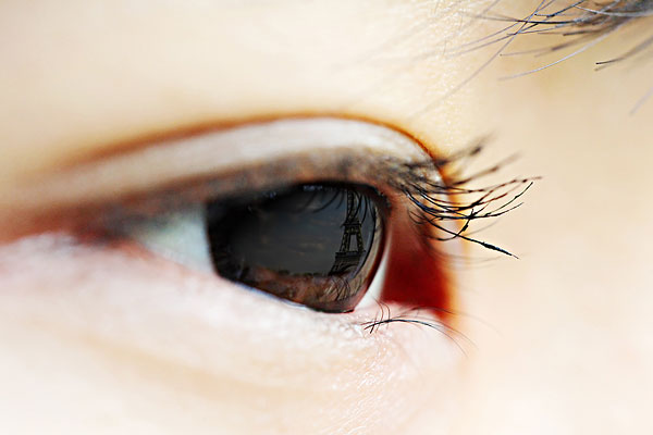 眼結(jié)石是怎么形成的？眼結(jié)石可以自己消失嗎？