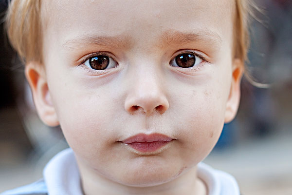 眼結(jié)石是怎么形成的？眼結(jié)石可以自己消失嗎？