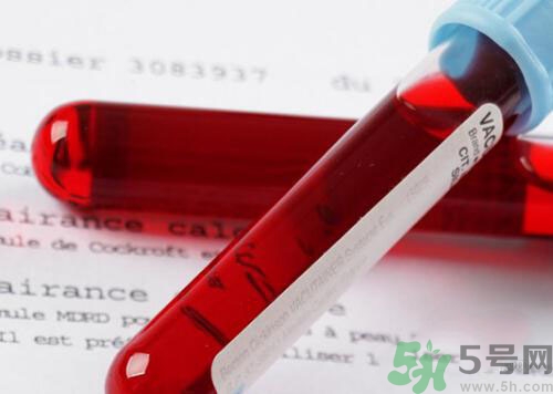 獻(xiàn)血后可以洗澡嗎？抽血后可以洗澡嗎？