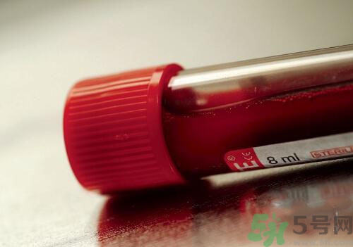 獻(xiàn)血后可以洗澡嗎？抽血后可以洗澡嗎？