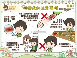 手被油燙傷了怎么處理？手被油燙起泡了怎么辦？