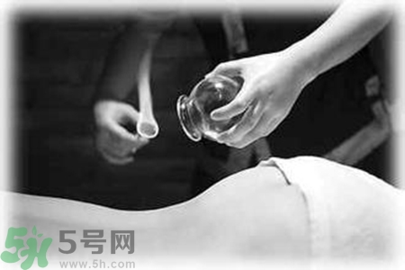 大暑可以拔罐嗎？大暑拔罐好不好？