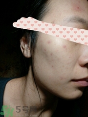 蔻詩(shī)彌黑面膜怎么樣?蔻詩(shī)彌黑面膜好用嗎?