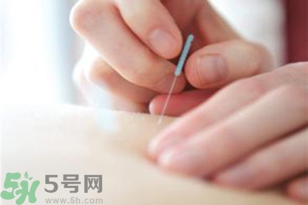 大暑可以針灸嗎？大暑針灸好不好？