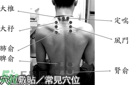 經(jīng)期可以貼三伏貼嗎？來月經(jīng)可以貼三伏貼嗎？