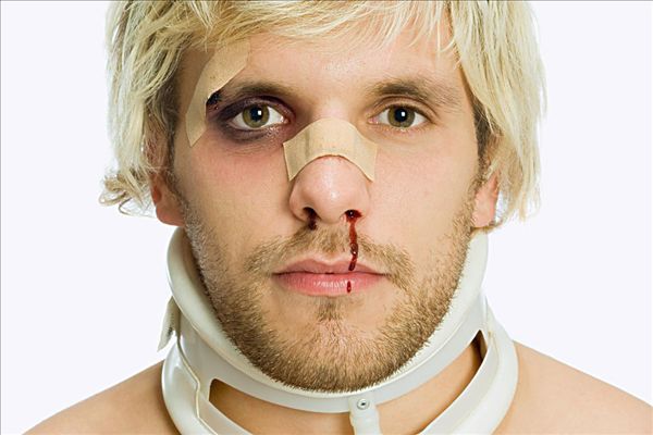 天氣太熱會流鼻血嗎？天氣太熱流鼻血是什么原因？