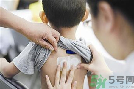 三伏貼能治頸椎病嗎？頸椎病三伏貼穴位