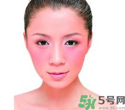 敏感性皮膚用什么洗面奶？敏感性皮膚怎么修復(fù)？