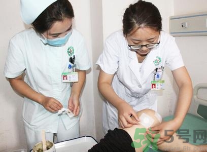 三伏貼可以自己貼嗎？三伏貼貼要找穴位嗎？