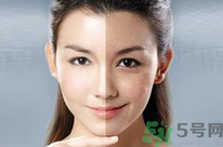 干性皮膚用什么洗面奶？干性皮膚該怎么保養(yǎng)？