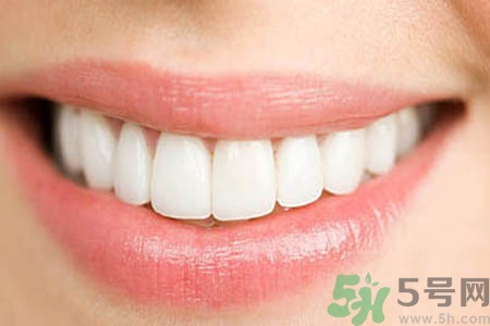 洗牙的好處有哪些？洗牙的好處是什么？