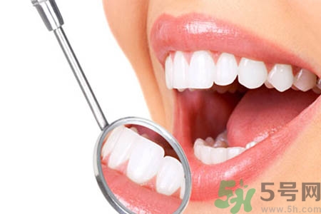 哪些人不能洗牙？洗牙需要注意什么？