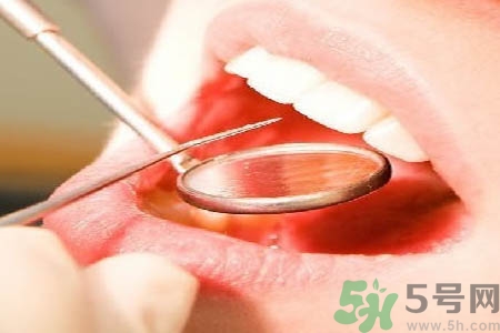 冷光美白牙齒是什么？冷光美白牙齒的好處有哪些？