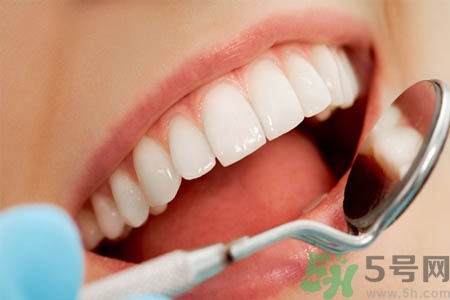 冷光美白牙齒的價(jià)格是多少？做冷光美白牙齒需要多少錢(qián)？