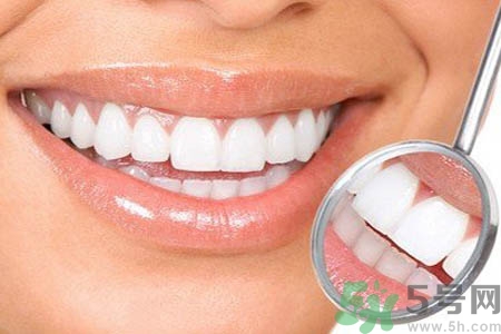 冷光美白牙齒可以保持多長(zhǎng)時(shí)間？冷光美白牙齒有副作用嗎？