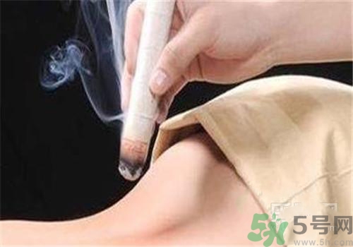 蕁麻疹可以艾灸嗎？蕁麻疹艾灸哪個(gè)穴位？