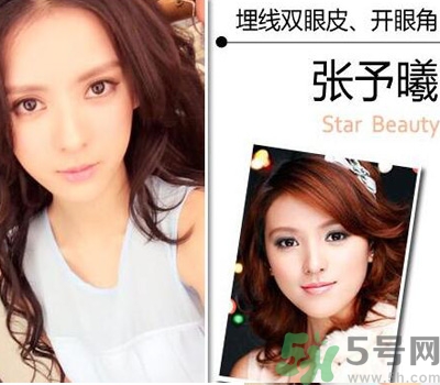 開眼角眼睛會變大嗎？開眼角眼睛能大多少？