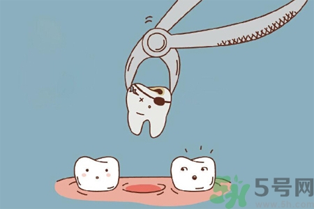 拔牙后需要注意什么？拔牙前需要注意什么？