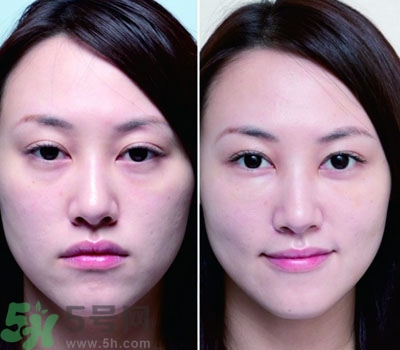 臥蠶是什么？臥蠶是眼袋嗎？