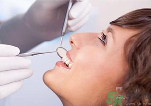 洗牙后多久可以刷牙？洗牙后怎么刷牙？